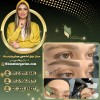 بهترین مرکز فیبروز ابرو در تهران با غزل زرگریان