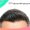 کاشت مو کلینیک رز