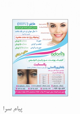 بوتاکس و تزریق ژل
