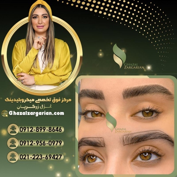 قیمت فیبروز ابرو در مرکز غزل زرگریان