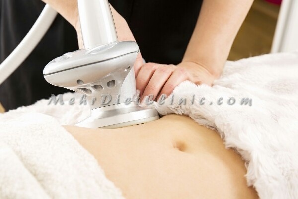 دستگاه لاغری موضعی