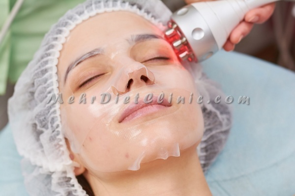 دستگاه لاغری آر اف RF چربی سوز صورت