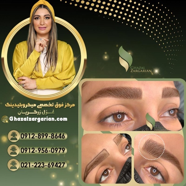 هزینه لیفت ابرو با مواد در آکادمی غزل زرگریان
